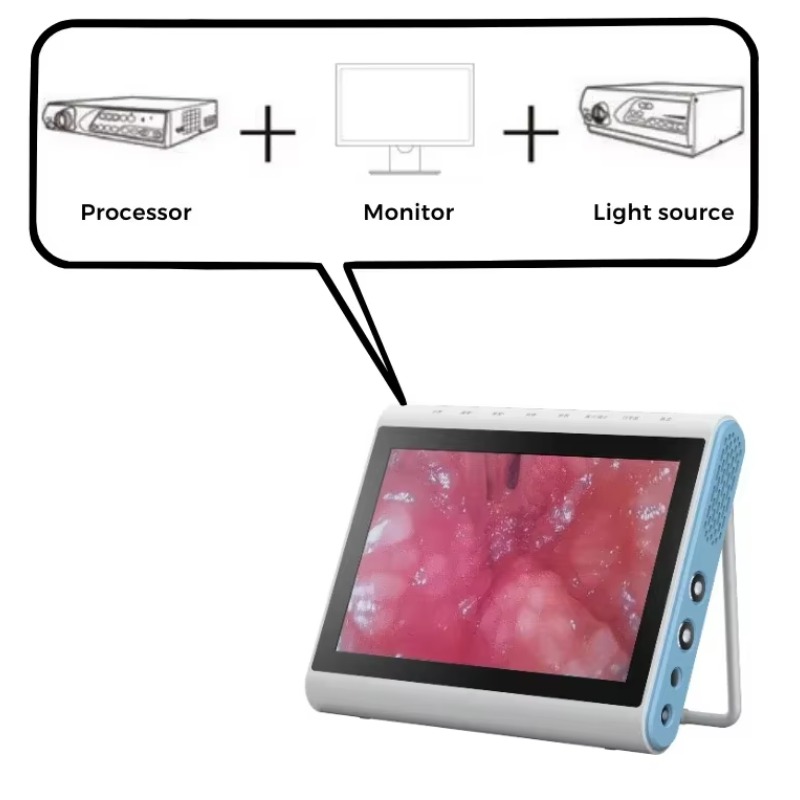 3'ü 1 Arada Tıbbi Endoskopi Gö - Medical Lab Images incelemesi ve fiyatı